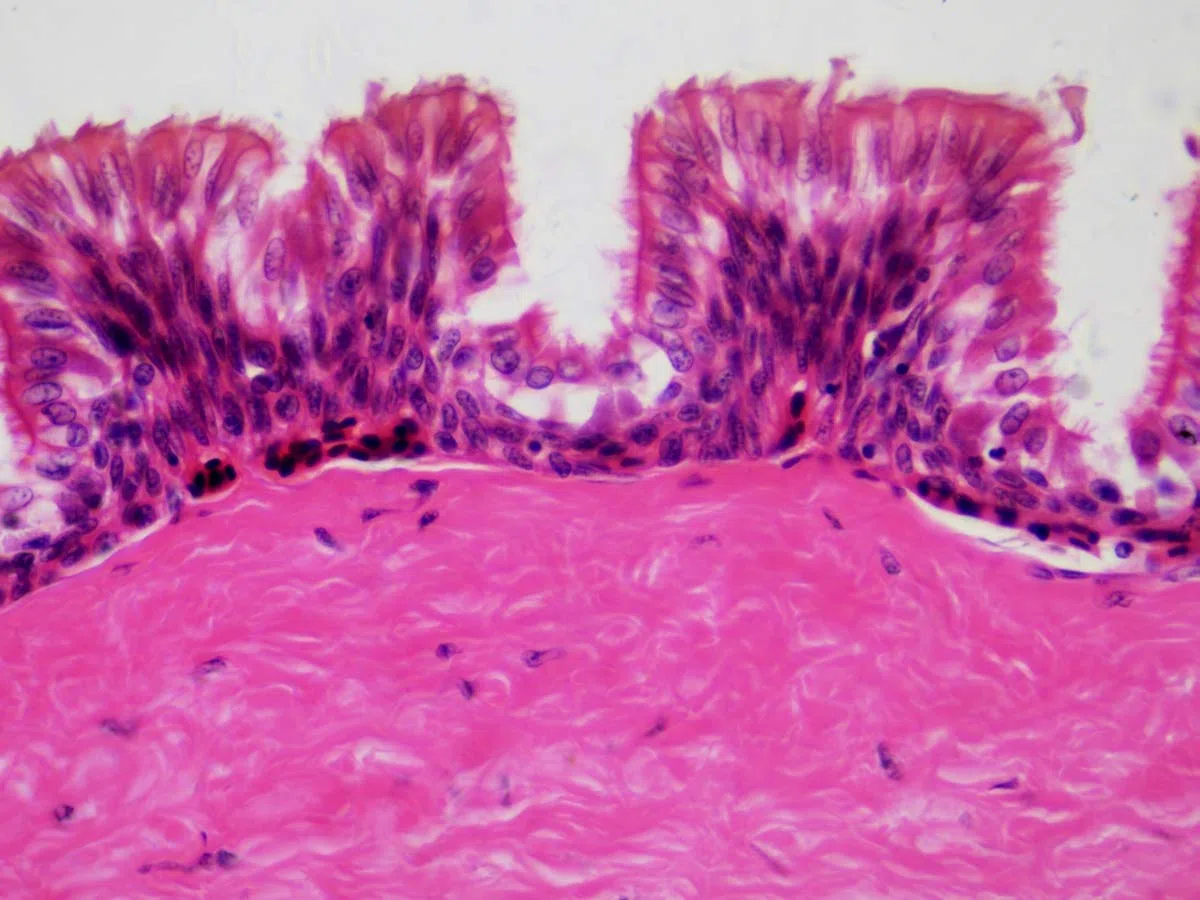 Bresser Muestras Preparadas: Histología