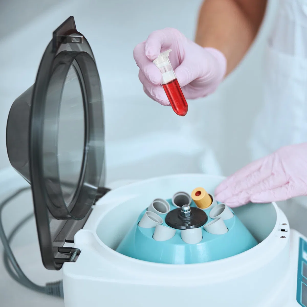 PATIKIL 2ML Tubos De Plástico Para Centrífuga, 500 Piezas Tubo Para Centrífuga De Fondo Redondo Con Tapa A Presión Y Marcas Graduadas Para Muestras De Laboratorio, Azul