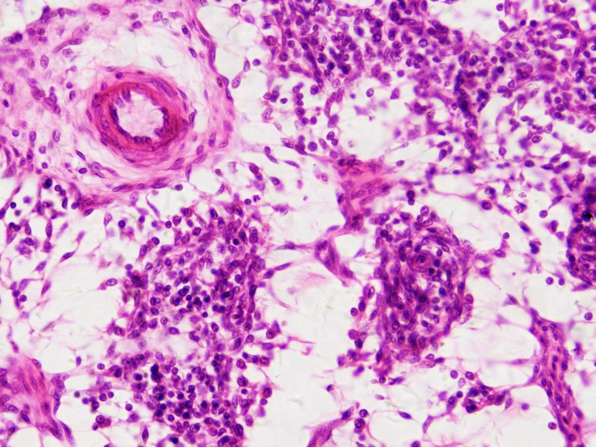Bresser Muestras Preparadas: Histología